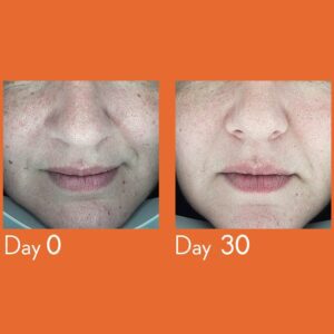 Youth-lab-Dark-Spot-Remover-Serum-30ml-2-1-4.jpg