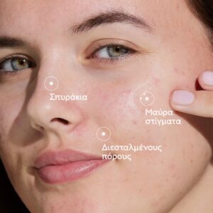 3_vinopure_serum_clinical2_v2_caudalie_el