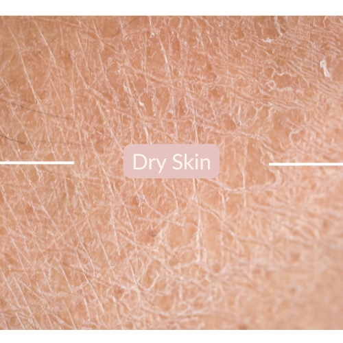 priceless products for dry skin